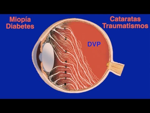 Vídeo: La punta de feltre es desprèn del vidre?