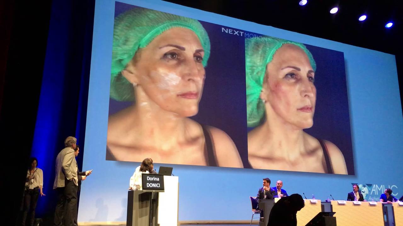 Use of Nextmotion in Salle des Princes