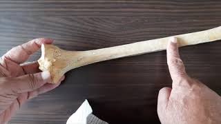 10. Tibia Part-II