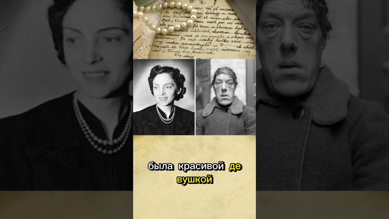 От красавицы до самой уродливой женщины мира. Мэри Вебстер.