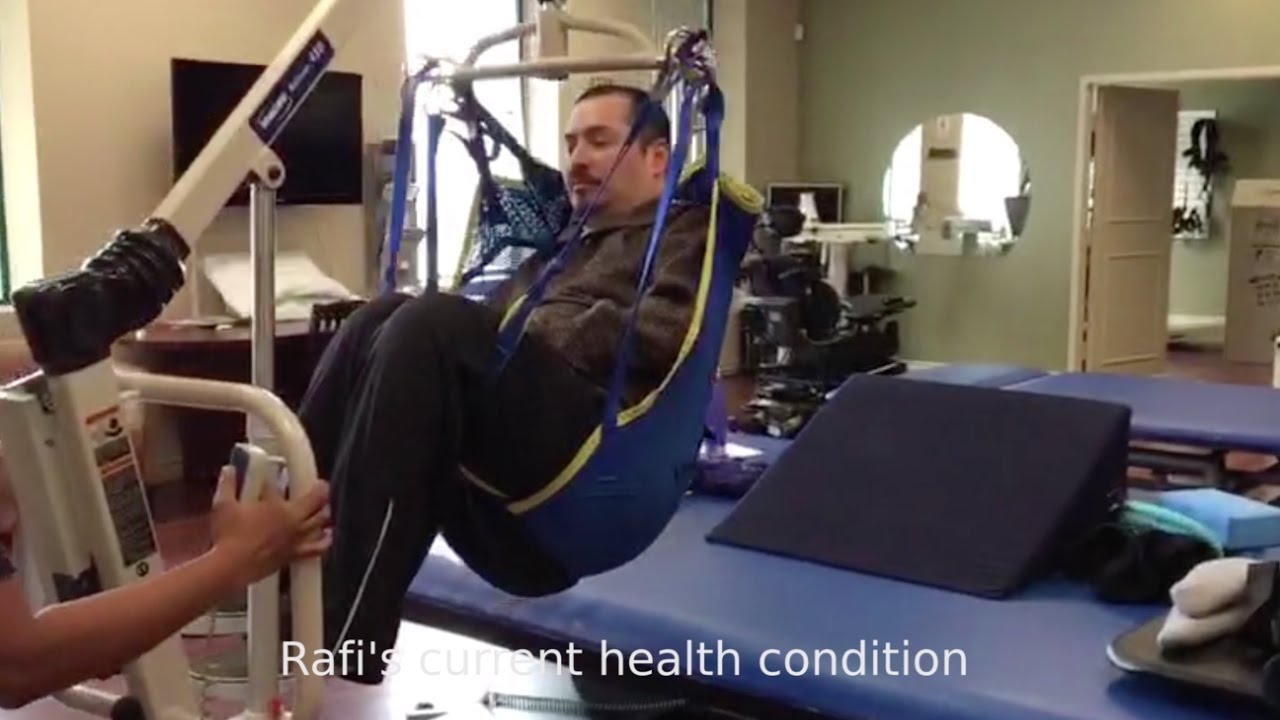 Stem Cell Therapy and Epidural Stimulation for Spinal Cord Injury YouTube