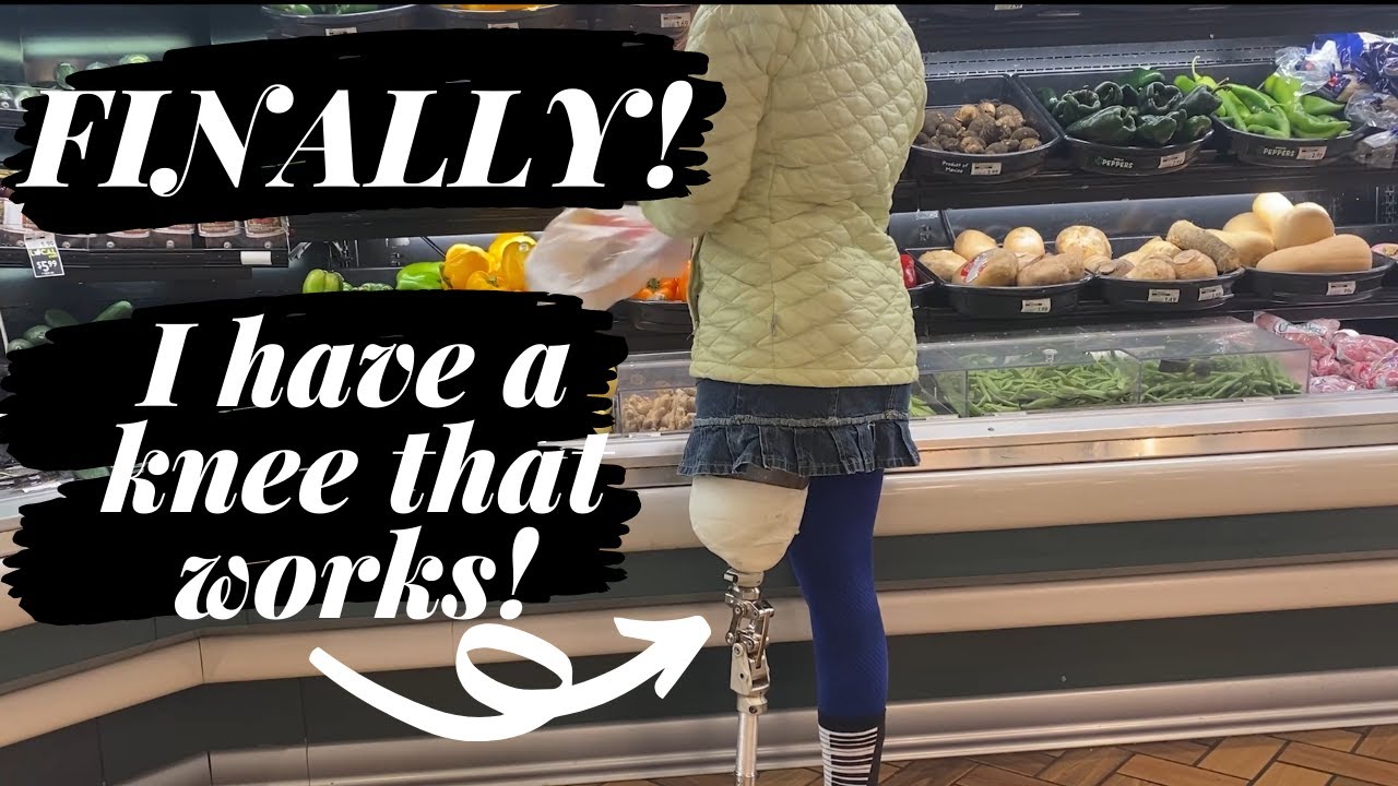 AK Amputee takes first steps outside of the clinic! My knee works! Ossur Total Knee 2000