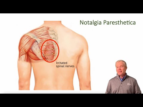 Video: 3 formas fáciles de tratar la Notalgia Paresthetica