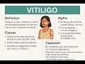 Vitiligo Myths, Facts, and Treatment Options for Junior Science Teachers & Students