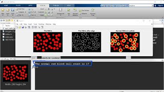 Count and Determine the normal red blood cells by MATLAB || Image Processing Using MATLAB