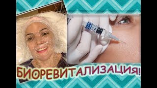 видео Процедура дня - пилинг кожи лица