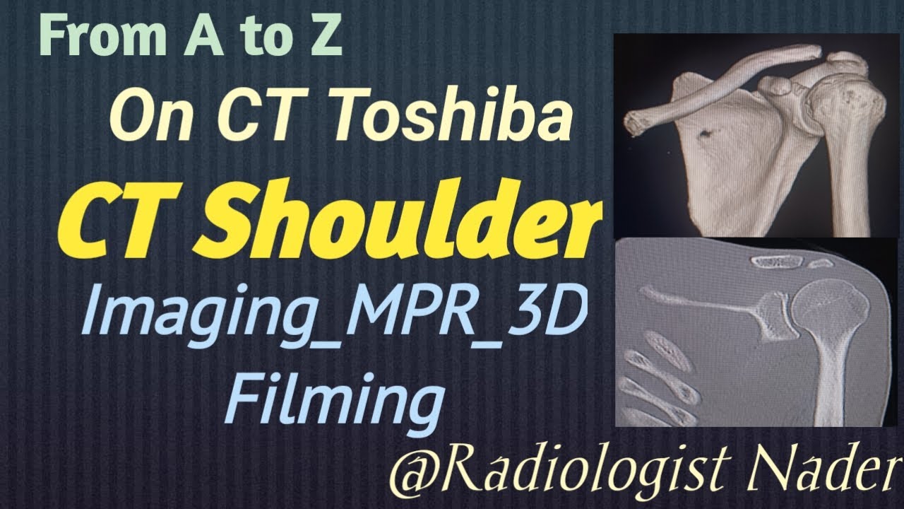 مقطعية علي الكتف|من الالف للياء| علي توشيبا 16