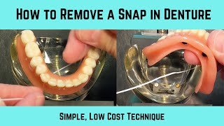 Simple trick to remove a snap in denture