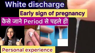 *White discharge* Personal Experience of Early Pregnancy Symptom ??