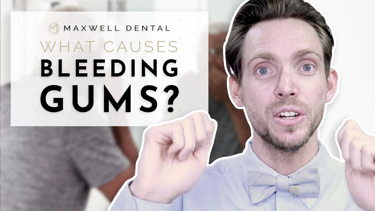 What Causes Bleeding Gums? 