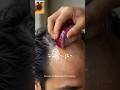 Stop Hair Loss Fast! Discover the Natural Secret to Stronger, Thicker & Healthier Hair. 🌿✨ #ytshorts