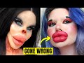 6 times plastic surgery went horribly wrong