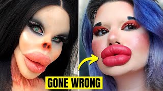 6 Times Plastic Surgery Went Horribly Wrong