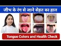 ज भ Tongue क र ग स ज न स हत क ह ल Tongue Colors Signs And Health ज भ Tongue क र ग स ज न स हत क ह ल Tongue Colors Signs And Health