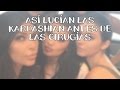 Así lucían las Kardashian antes de las cirugías