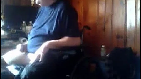 Test Socket Try Out for Prosthetic Leg