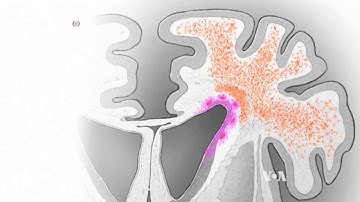 Scientists Find New Stage of Development in Babies