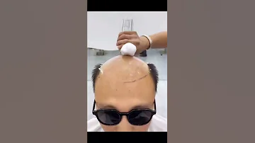 باروكة شعر للرجال 