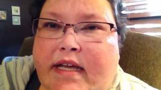 Lupus 1-9-12 Better... Stem Cell Transplant