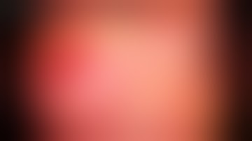 Caecal wall injury & suture at appendectomy-series 6