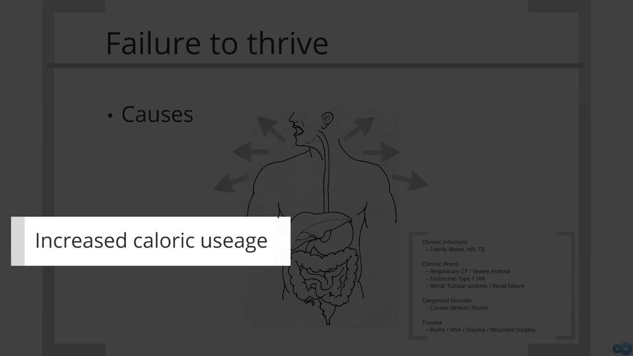 Paediatrics - failure to thrive