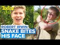 Robert Irwin bitten on face by snake | Today Show Australia