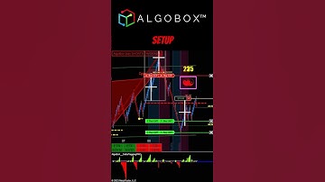 Day Trading With Edge 🔴 Get Confidence Through Confluence