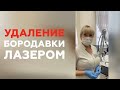 УДАЛЕНИЕ БОРОДАВКИ ЛАЗЕРОМ
