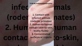 #Mpox #california mpox cases #monkeypox #monkey pox #mpox california