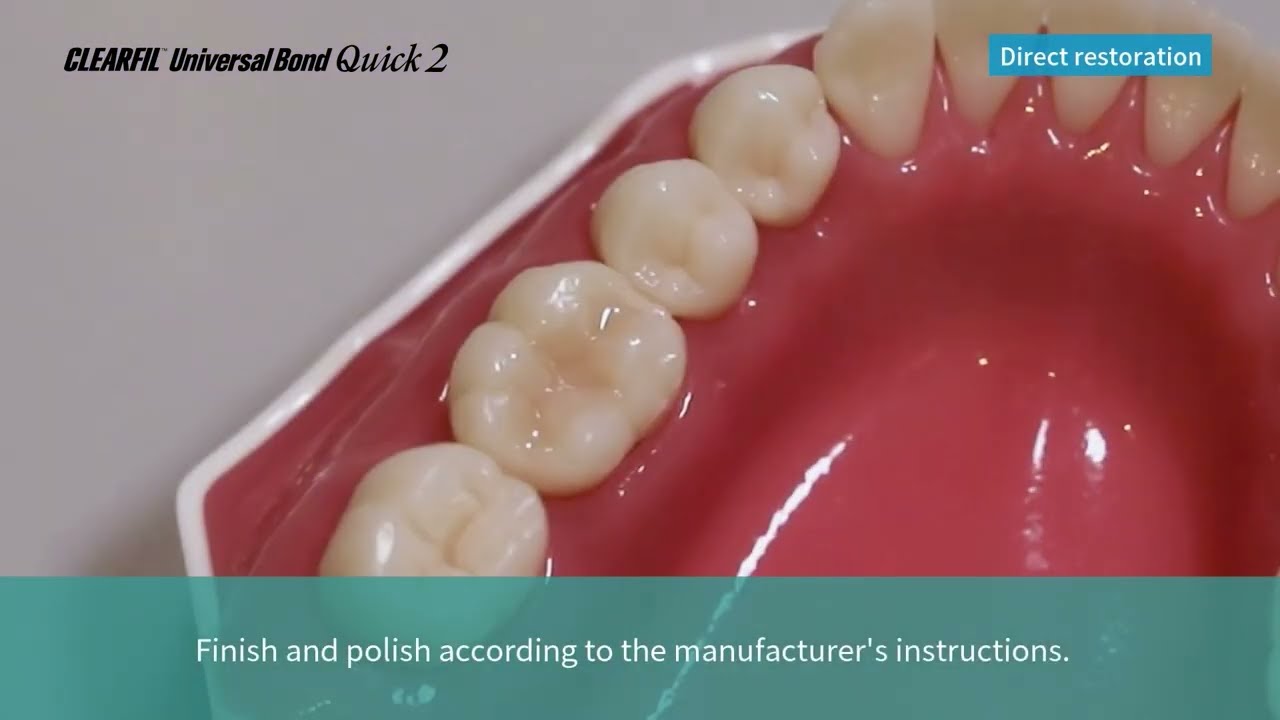 How to with UBQ2: Direct Restoration with CLEARFIL MAJESTY ES Flow