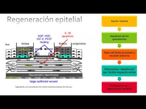 Erosion Corneal Recurrente