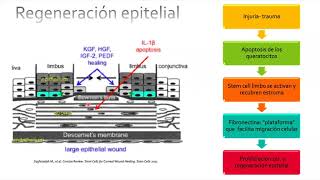 Erosion Corneal Recurrente
