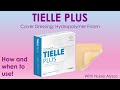 TIELLE Plus: when and how to use