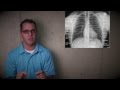 chest radiography part I