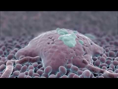 Video: Wie Sieht Mundkrebs Aus? 5 Bilder Von Mundkrebs