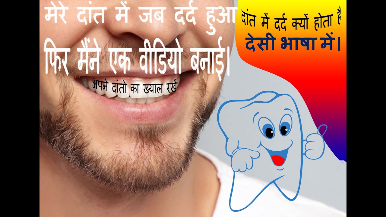 Dant Ki RCT Kaise Hoti Hai ,One Electrician Explain Teeth RCT YouTube