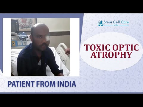 Toxic Optic Atrophy Patient shares his experience at SCCI| Toxic Optic Atrophy | Stem Cell Therapy |