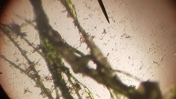 Cyanobacteria Under the Microscope - The "Devils Spit" AKA Blue/Green Algea. (Part 2/2)