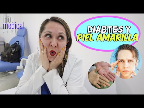 ¿PIEL AMARILLA EN
