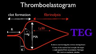 Thromboelastogram || TEG