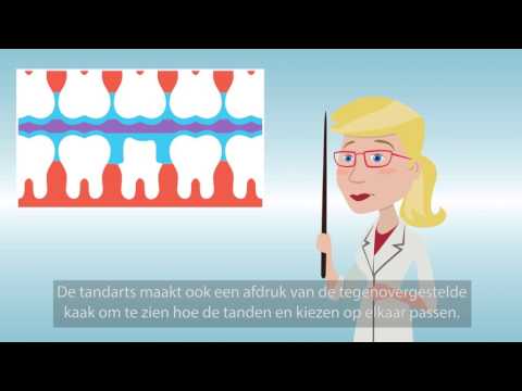 Video: Hoe Om 'n Tandheelkundige Kroon Te Kies