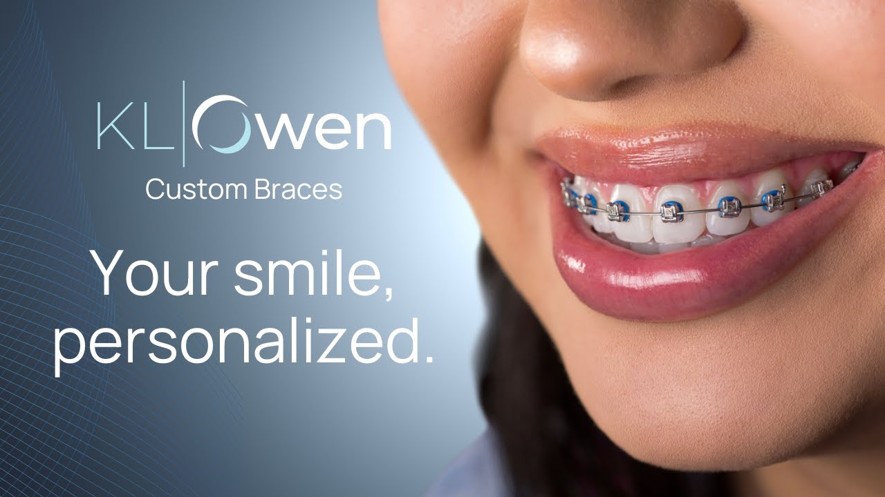 klowen braces klowen #orthodontics #braces #digitalhealth #digitalorthodontics  #orthodonticsolutions #orthodontist #dentalhealth #custombraces  #3dprintedbraces #healthtech main image 0