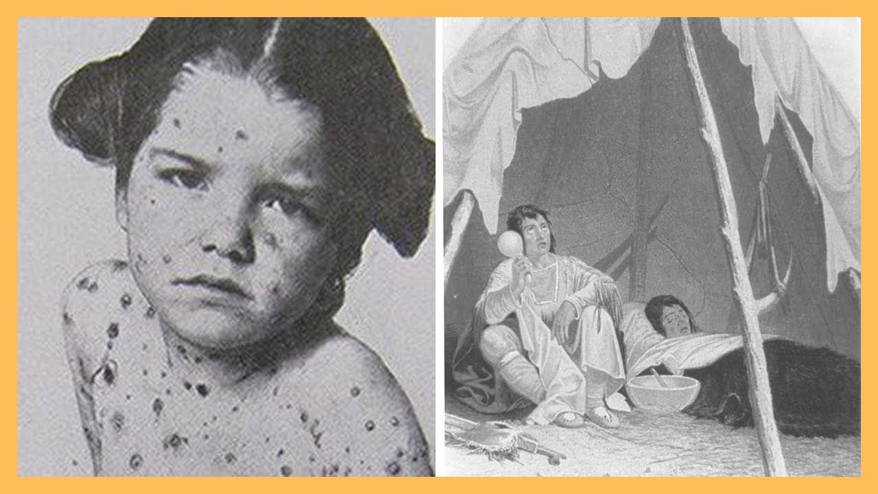 Top 10 Epidemic Diseases That Were Common in the Ancient World - YouTube