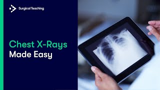 Chest X-Rays Made Easy screenshot 4