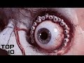 Top 10 Scary Diseases That Could Wipe Out Humans - Part 2