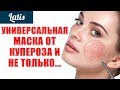 УНИВЕРСАЛЬНАЯ МАСКА ОТ КУПЕРОЗА И НЕ ТОЛЬКО...