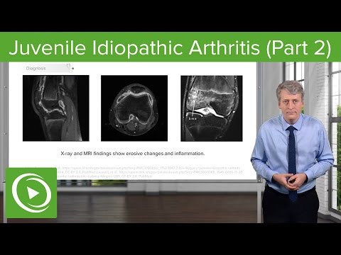 Video: Why Is Idiopathic Arthritis Dangerous?