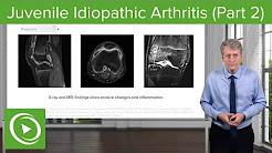 Juvenile Idiopathic Arthritis (JIA): Diagnosis & Management – Pediatrics | Lecturio