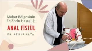 Op. Dr. Atilla Kaya Anlatımı ile Makat Bölgesinin En Zorlu Hastalığı - Anal Fistül