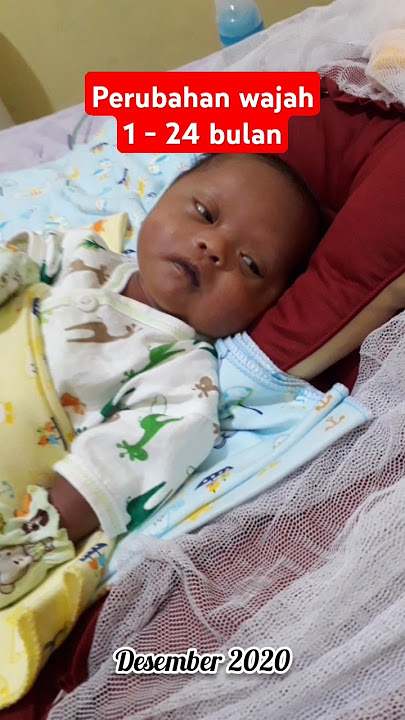 perubahan wajah bayi down syndrome 1 - 24 bulan #arsakafamily #downsyndrome #downsyndromeindonesia